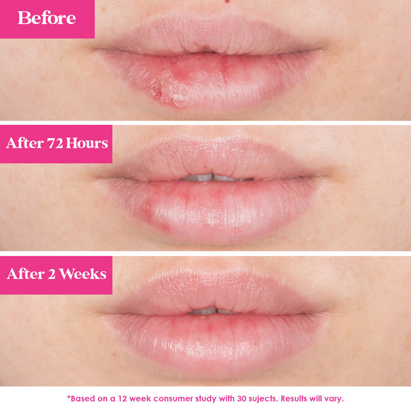 GrandePOUT Plumping Lip Mask