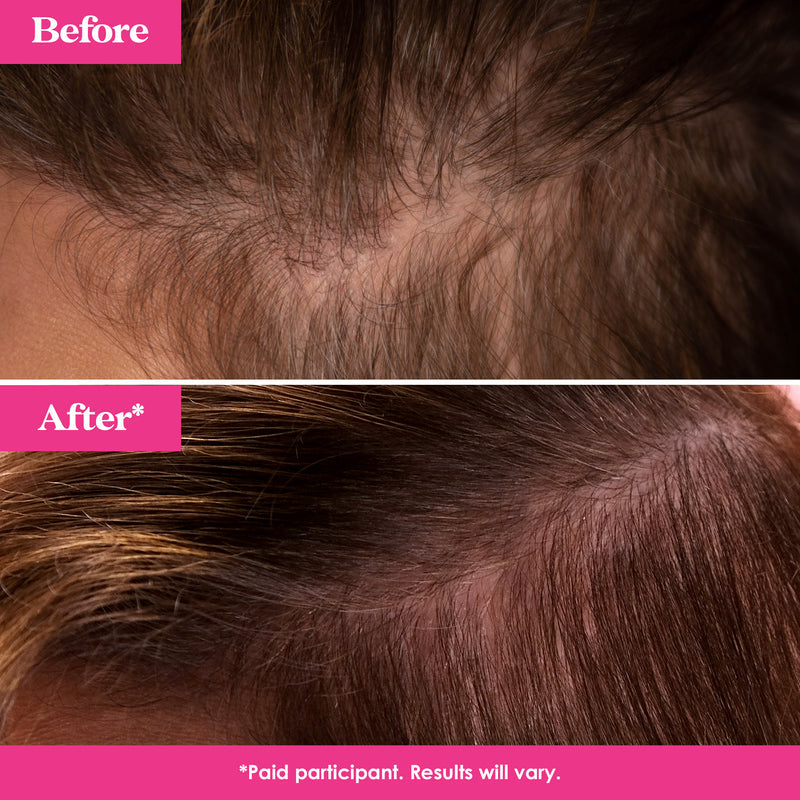 GrandeHAIR | Hair Enhancing Serum